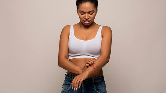 Comprendre et Gérer l’Eczéma : Conseils et Solutions avec Karikemité